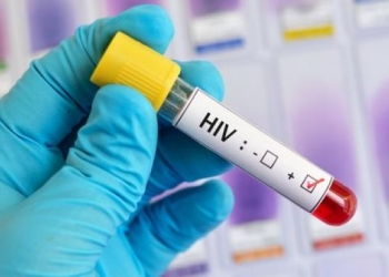 Ilustrasi terjangkit HIV-AIDS. (Foto: Dok. Shutterstock)