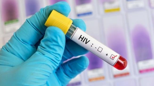 Ilustrasi terjangkit HIV-AIDS. (Foto: Dok. Shutterstock)